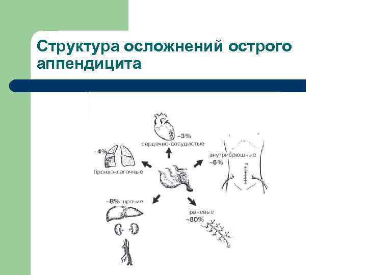 Структура осложнений острого аппендицита 