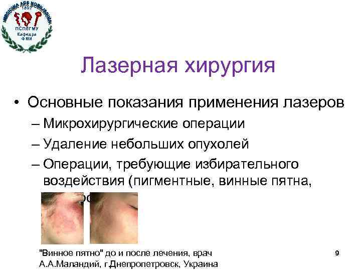 1897 ПСПб. ГМУ Кафедра ФМИ Лазерная хирургия • Основные показания применения лазеров – Микрохирургические