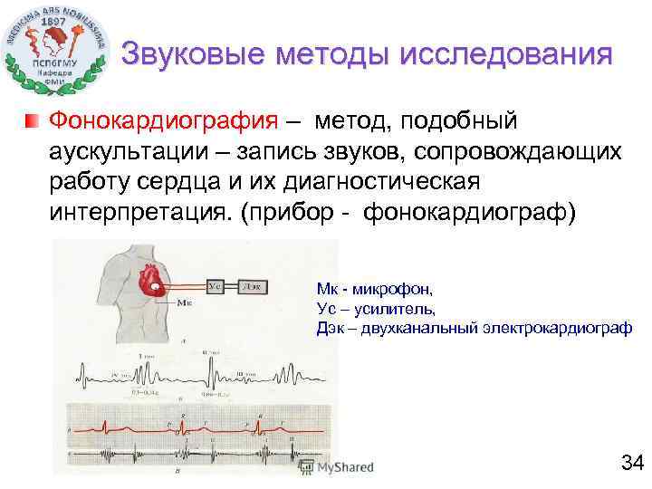 Звуковые методы исследования Фонокардиография – метод, подобный аускультации – запись звуков, сопровождающих работу сердца