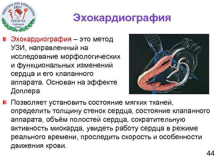 Эхокардиография – это метод УЗИ, направленный на исследование морфологических и функциональных изменений сердца и