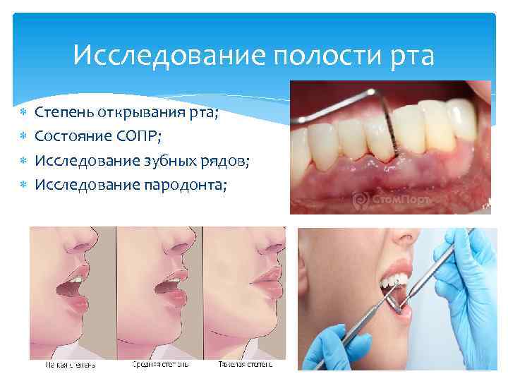 Исследование полости рта Степень открывания рта; Состояние СОПР; Исследование зубных рядов; Исследование пародонта; 