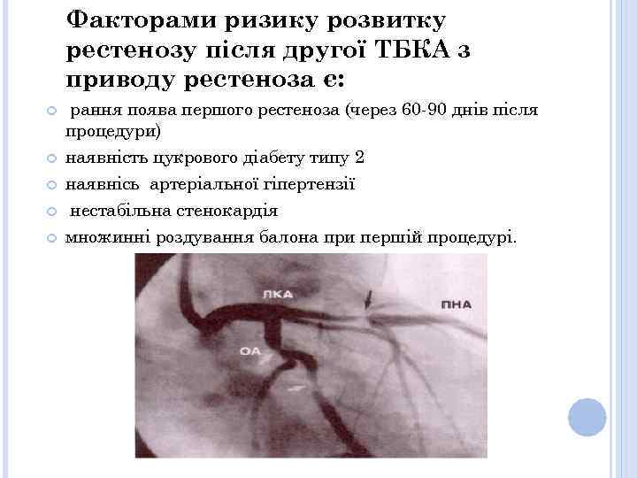 Факторами ризику розвитку рестенозу після другої ТБКА з приводу рестеноза є: рання поява першого