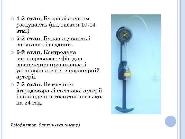  4 -й етап. Балон зі стентом роздувають (під тиском 10 -14 атм. )