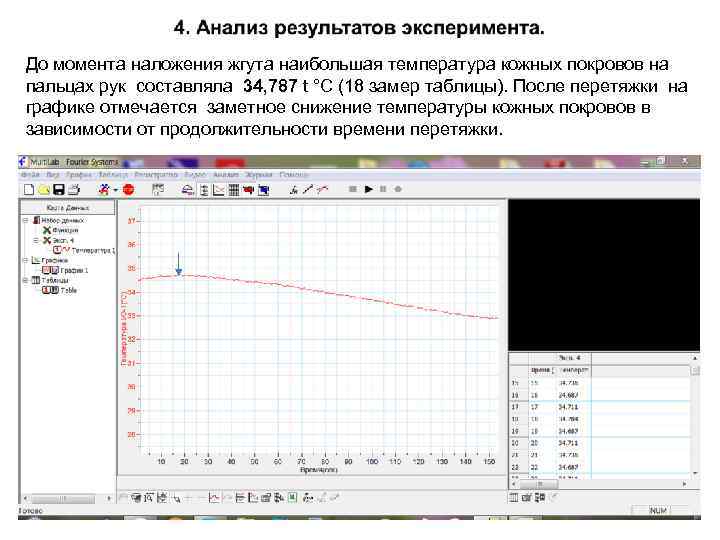 До момента наложения жгута наибольшая температура кожных покровов на пальцах рук составляла 34, 787