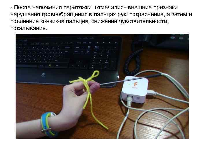 - После наложения перетяжки отмечались внешние признаки нарушения кровообращения в пальцах рук: покраснение, а