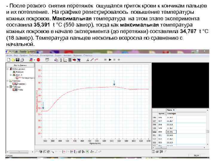 - После резкого снятия перетяжек ощущался приток крови к кончикам пальцев и их потепление.