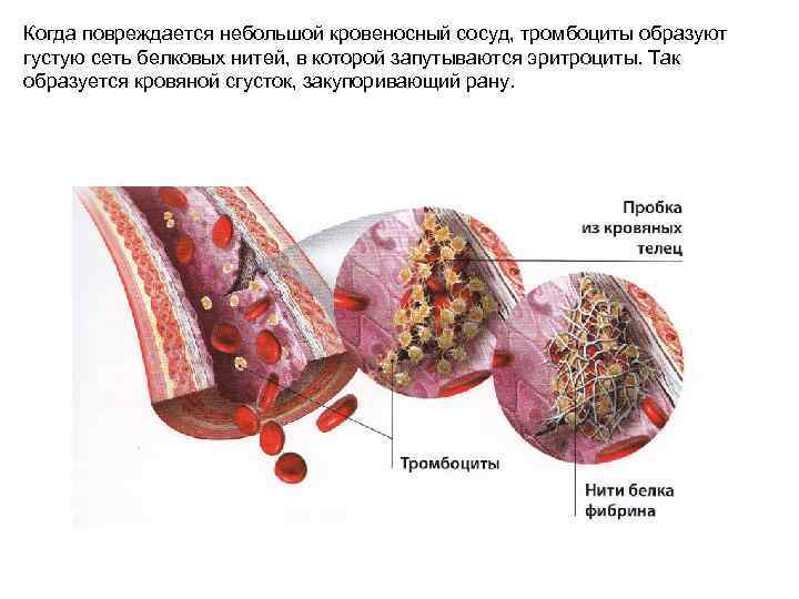 Когда повреждается небольшой кровеносный сосуд, тромбоциты образуют густую сеть белковых нитей, в которой запутываются