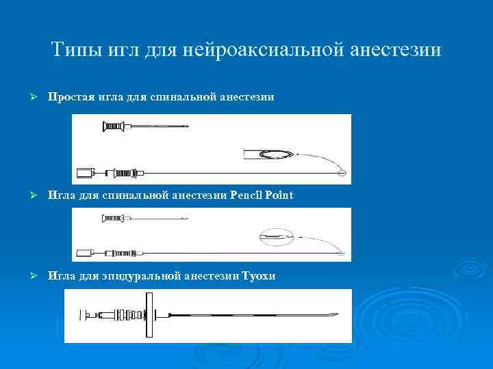 Типы игл для нейроаксиальной анестезии Ø Простая игла для спинальной анестезии Ø Игла для