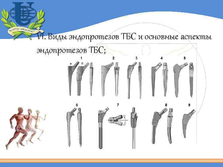 VI. Виды эндопротезов ТБС и основные аспекты эндопротезов ТБС; 