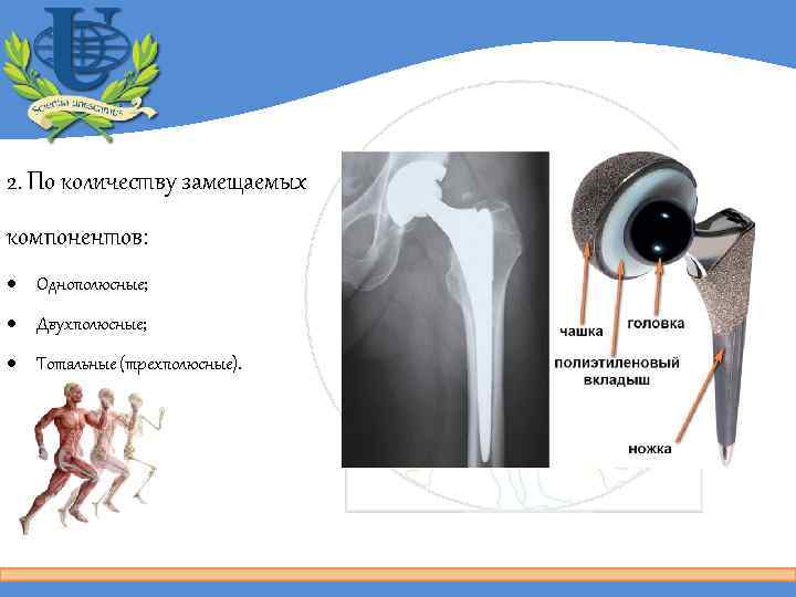 2. По количеству замещаемых компонентов: Однополюсные; Двухполюсные; Тотальные (трехполюсные). 