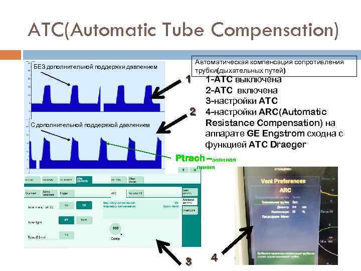 ATC(Automatic Tube Compensation) БЕЗ дополнительной поддержки давлением 1 Автоматическая компенсация сопротивления трубки(дыхательных путей) 2