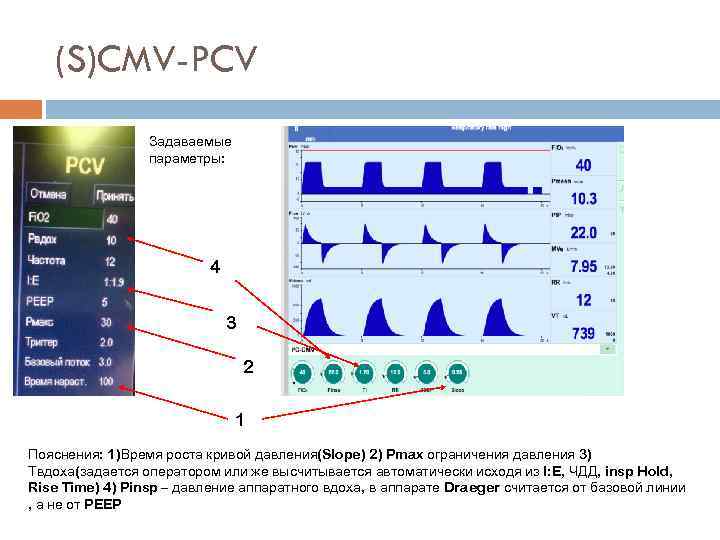 (S)CMV-PCV Задаваемые параметры: 4 3 2 1 Пояснения: 1)Время роста кривой давления(Slope) 2) Pmax