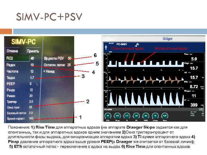 SIMV-PC+PSV Спонтанный вдох Аппаратный вдох 6 5 4 3 2 1 Пояснения: 1) Rise