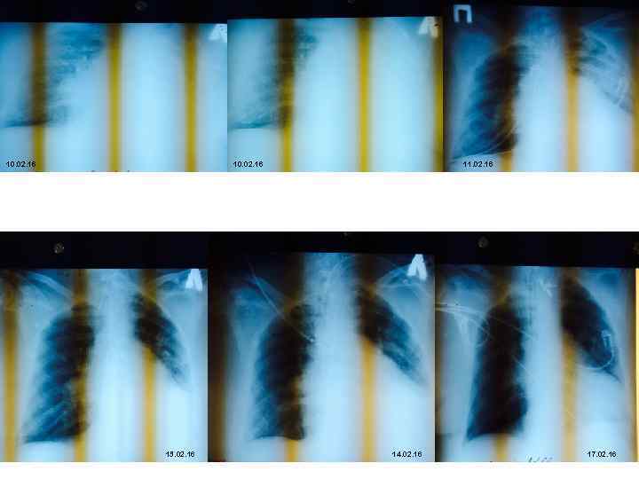 10. 02. 16 13. 02. 16 11. 02. 16 14. 02. 16 17. 02.