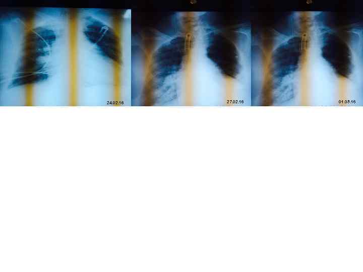 24. 02. 16 27. 02. 16 01. 03. 16 