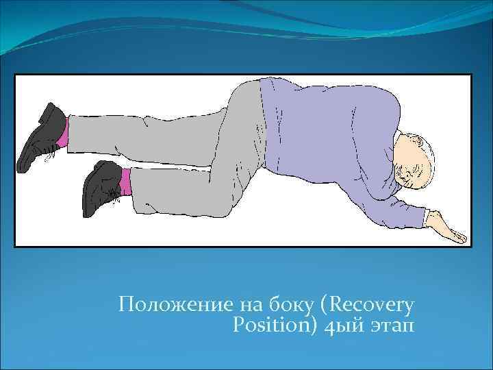 Положение на боку (Recovery Position) 4 ый этап 