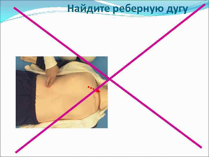 Найдите реберную дугу 