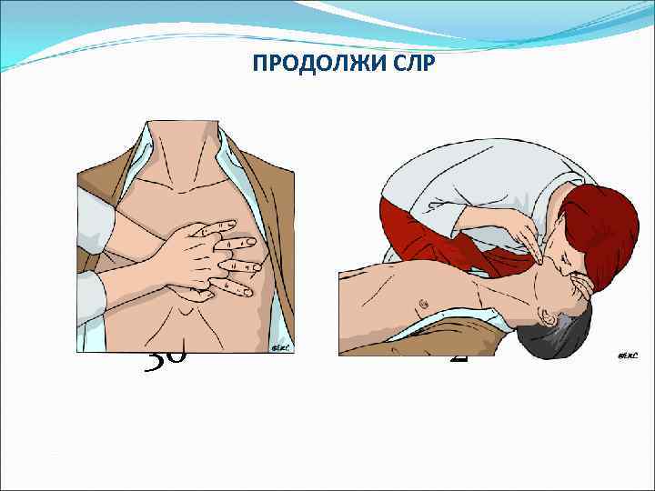 ПРОДОЛЖИ СЛР 30 2 