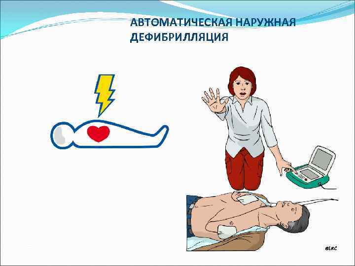 АВТОМАТИЧЕСКАЯ НАРУЖНАЯ ДЕФИБРИЛЛЯЦИЯ 