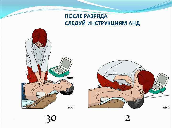 ПОСЛЕ РАЗРЯДА СЛЕДУЙ ИНСТРУКЦИЯМ АНД 30 2 