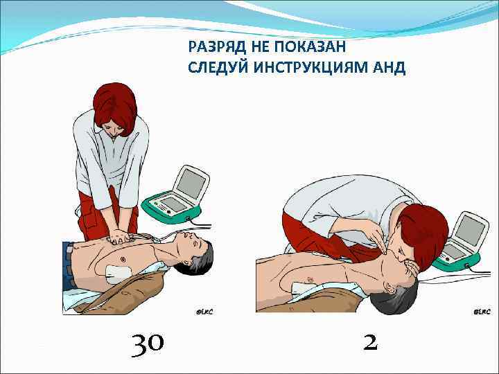 РАЗРЯД НЕ ПОКАЗАН СЛЕДУЙ ИНСТРУКЦИЯМ АНД 30 2 