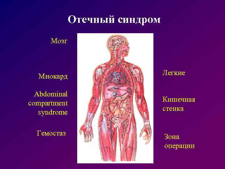 Отечный синдром Мозг Миокард Abdominal compartment syndrome Гемостаз Легкие Кишечная стенка Зона операции 