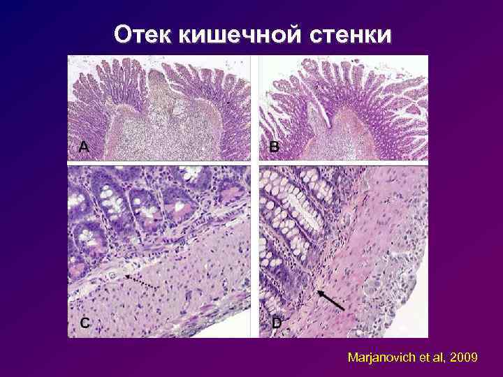 Отек кишечной стенки Marjanovich et al, 2009 