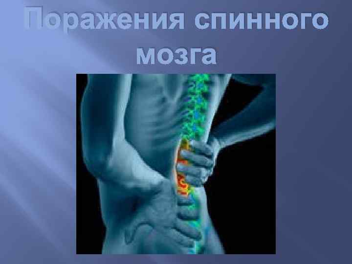Поражения спинного мозга 