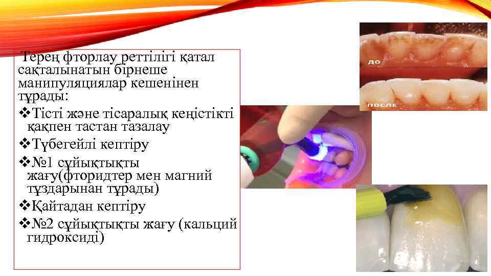 Терең фторлау реттілігі қатал сақталынатын бірнеше манипуляциялар кешенінен тұрады: v. Тісті және тісаралық кеңістікті