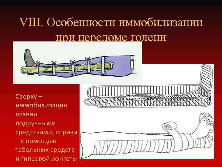 Подручные и табельные средства транспортной иммобилизации