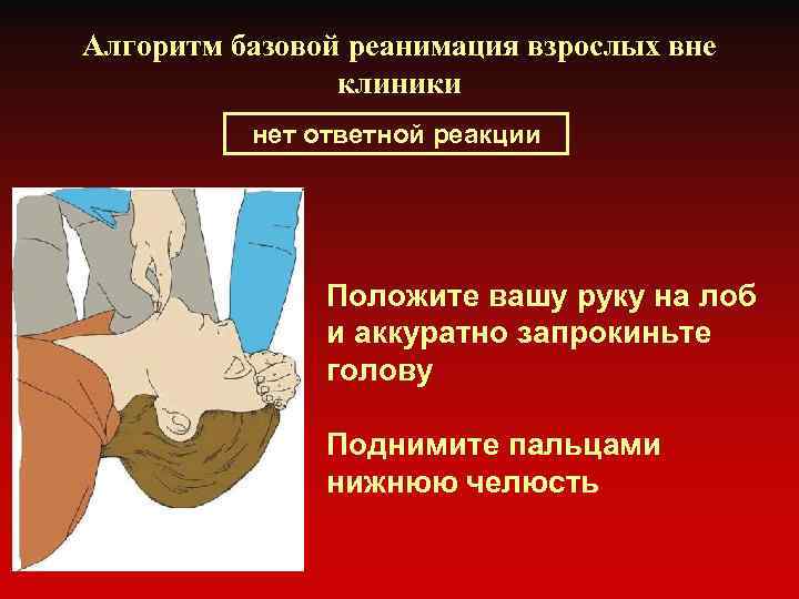 Алгоритм базовой реанимация взрослых вне клиники нет ответной реакции Положите вашу руку на лоб