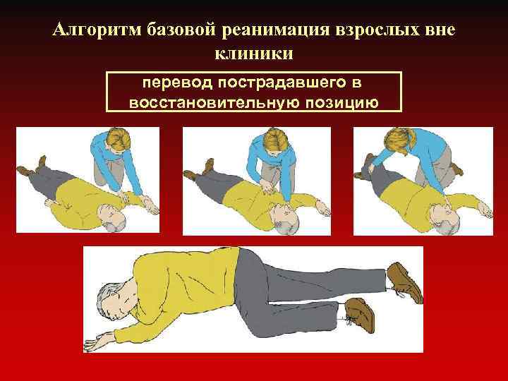 Алгоритм базовой реанимация взрослых вне клиники перевод пострадавшего в восстановительную позицию 