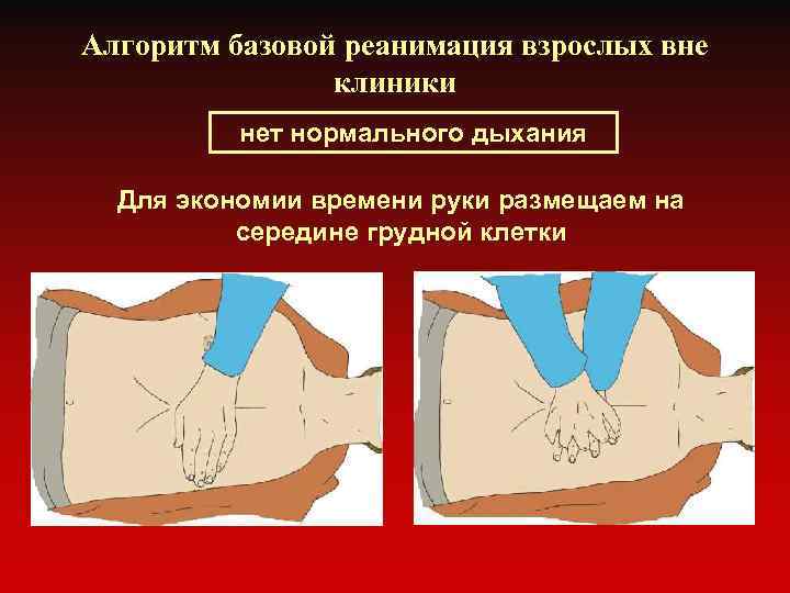 Алгоритм базовой реанимация взрослых вне клиники нет нормального дыхания Для экономии времени руки размещаем