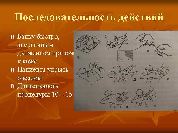 Последовательность действий n Банку быстро, энергичным движением приложить к коже n Пациента укрыть одеялом