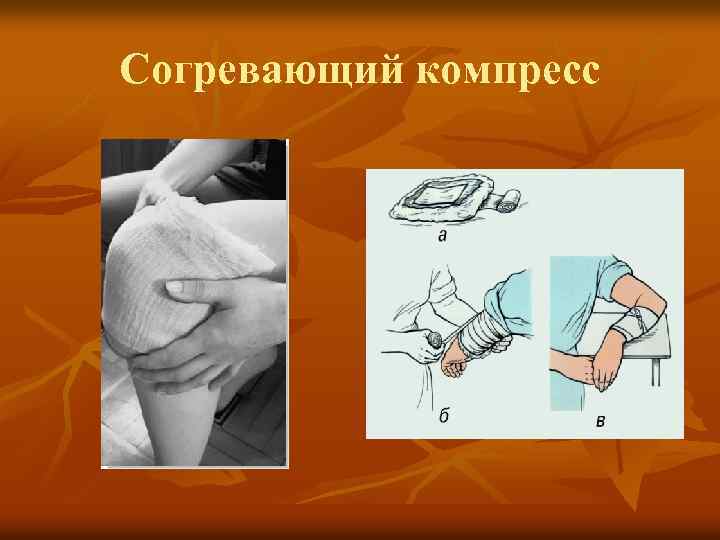 Согревающий компресс 