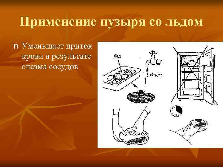 Пузырь со льдом показания