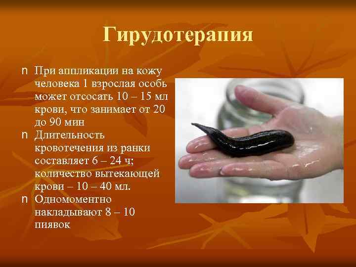 Гирудотерапия n При аппликации на кожу человека 1 взрослая особь может отсосать 10 –