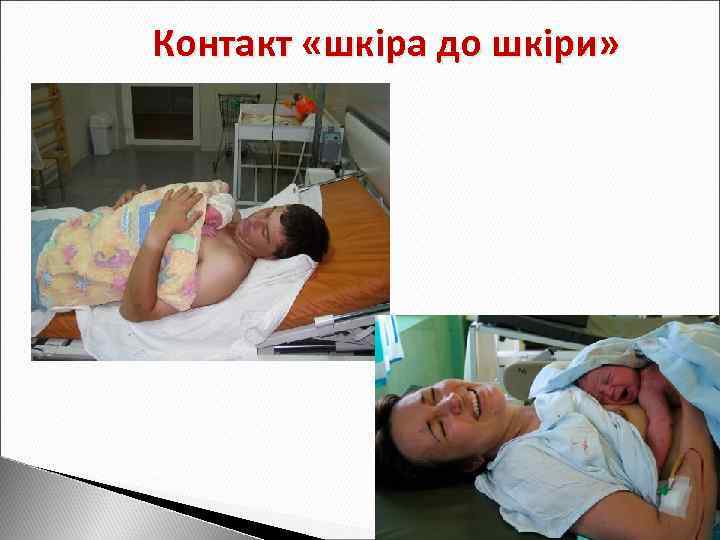 Контакт «шкіра до шкіри» 