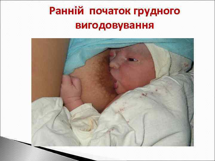 Ранній початок грудного вигодовування 