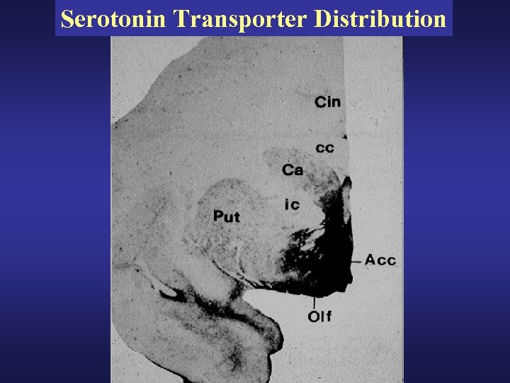 Serotonin Transporter Distribution 