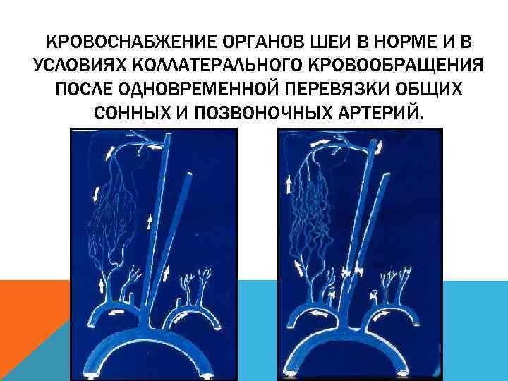 КРОВОСНАБЖЕНИЕ ОРГАНОВ ШЕИ В НОРМЕ И В УСЛОВИЯХ КОЛЛАТЕРАЛЬНОГО КРОВООБРАЩЕНИЯ ПОСЛЕ ОДНОВРЕМЕННОЙ ПЕРЕВЯЗКИ ОБЩИХ