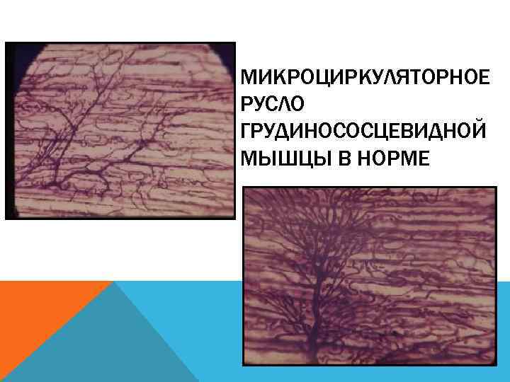 МИКРОЦИРКУЛЯТОРНОЕ РУСЛО ГРУДИНОСОСЦЕВИДНОЙ МЫШЦЫ В НОРМЕ 