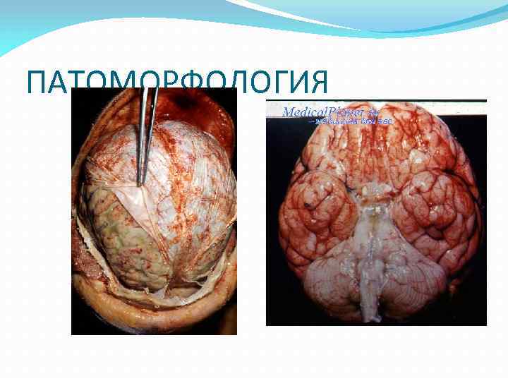 ПАТОМОРФОЛОГИЯ 