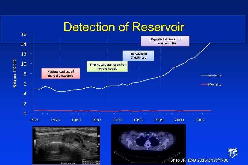 Detection of Reservoir Rate per 100 000 US-guided aspiration of thyroid nodules Increased in