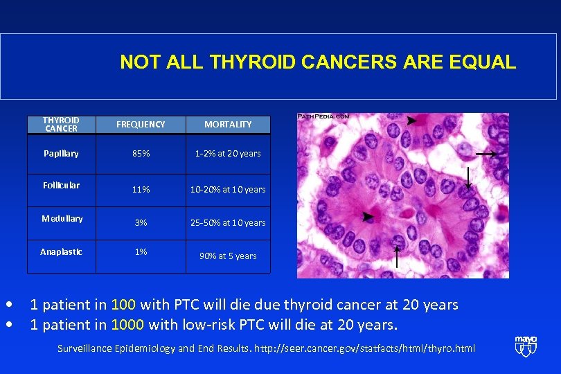 NOT ALL THYROID CANCERS ARE EQUAL THYROID CANCER FREQUENCY MORTALITY Papillary 85% 1 -2%