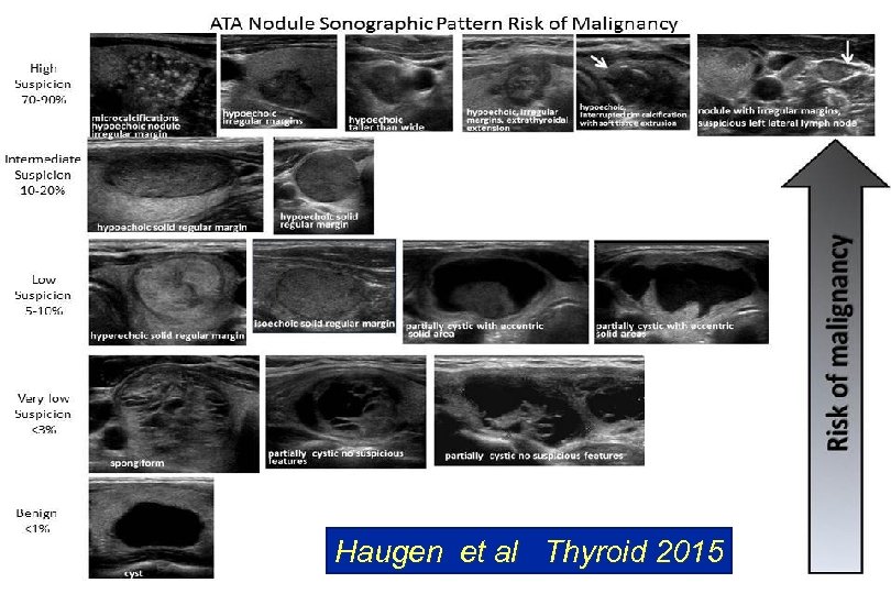 Haugen et al Thyroid 2015 