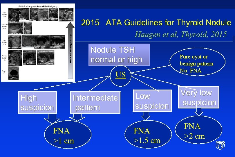  2015 ATA Guidelines for Thyroid Nodule Haugen et al, Thyroid, 2015 Nodule TSH