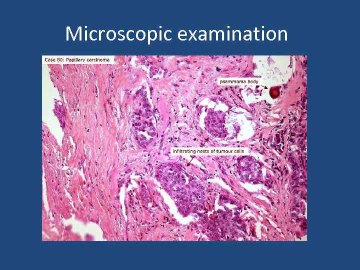 Microscopic examination 