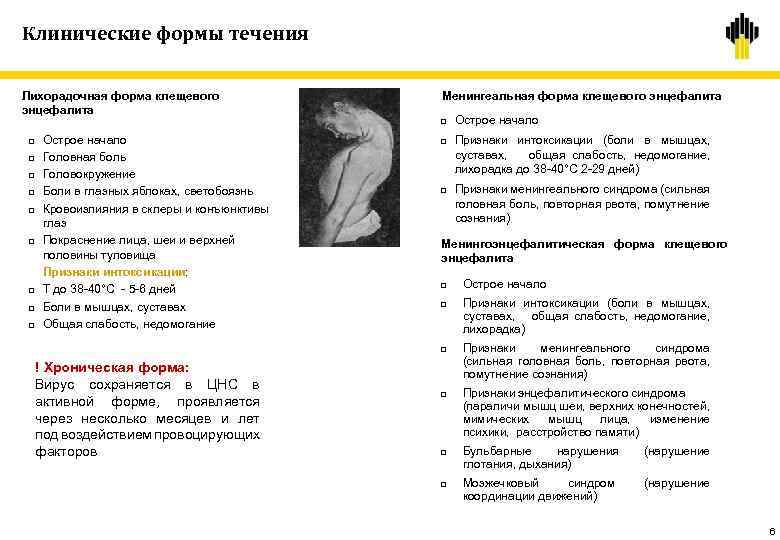 Клинические формы течения Лихорадочная форма клещевого энцефалита Менингеальная форма клещевого энцефалита q q q