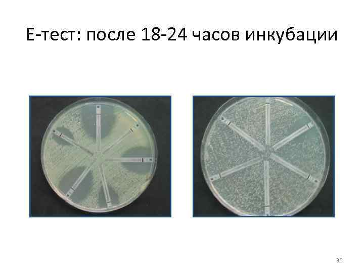 Е тест: после 18 24 часов инкубации 36 